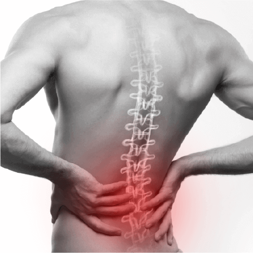 Back / Lower Back Soreness