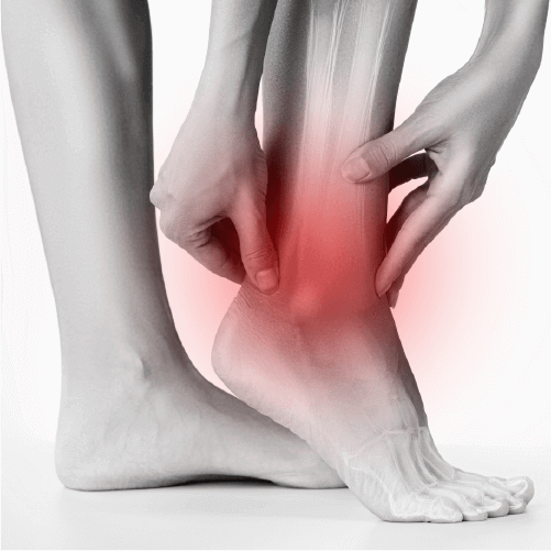 Strain Sprain